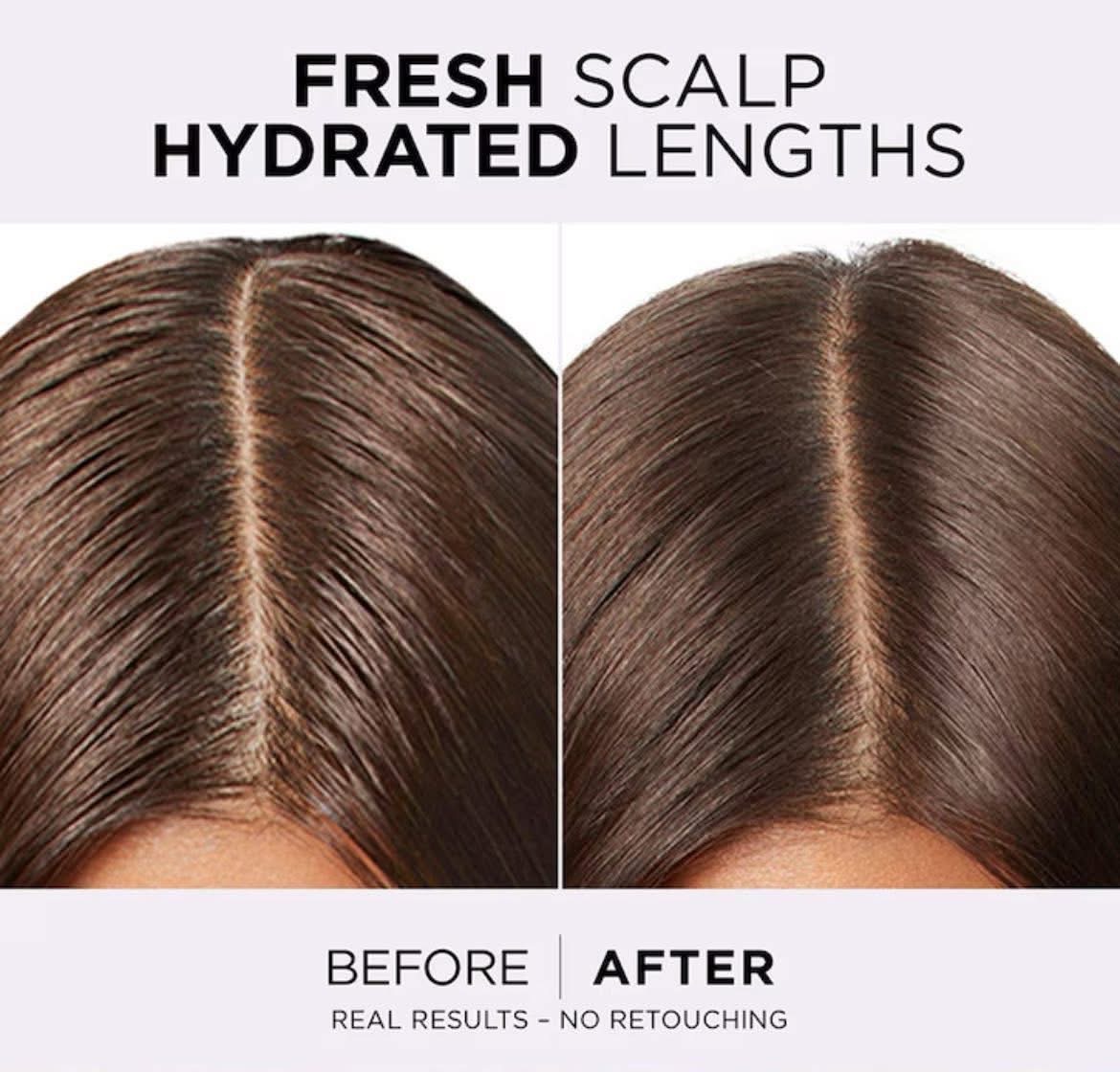 Loreal Paris Elseve Hyaluron Shampoo image 2